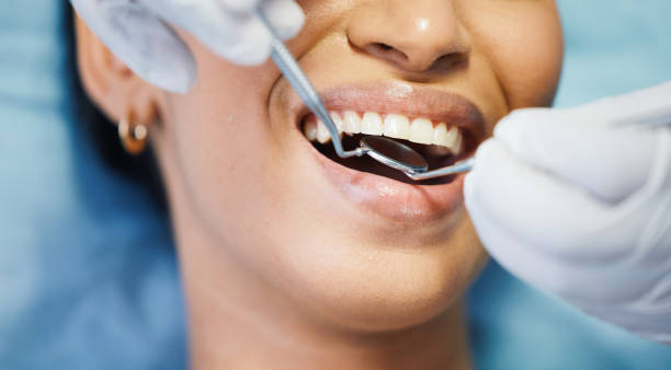 Best Emergency Tooth Extraction in Conway, SC